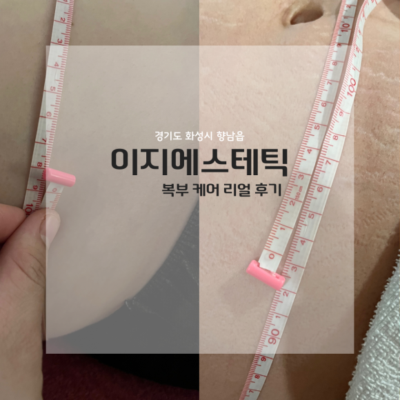 이지에스테틱 이미지