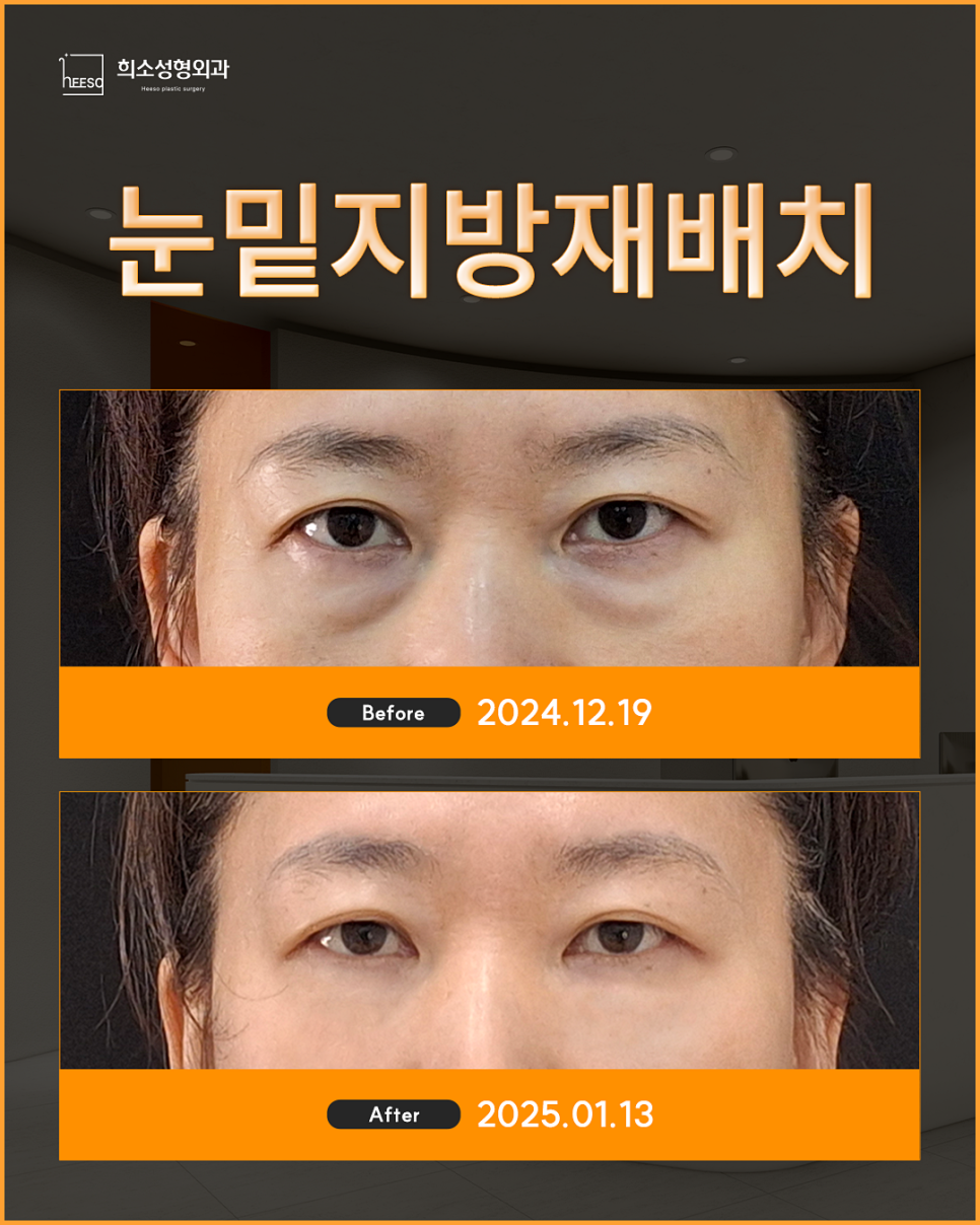 희소성형외과의원 이미지