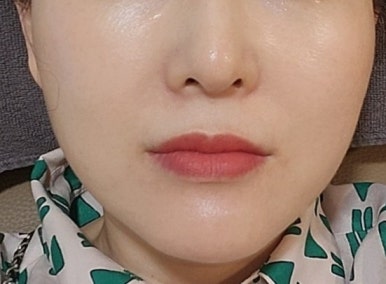 예스압구정 이미지