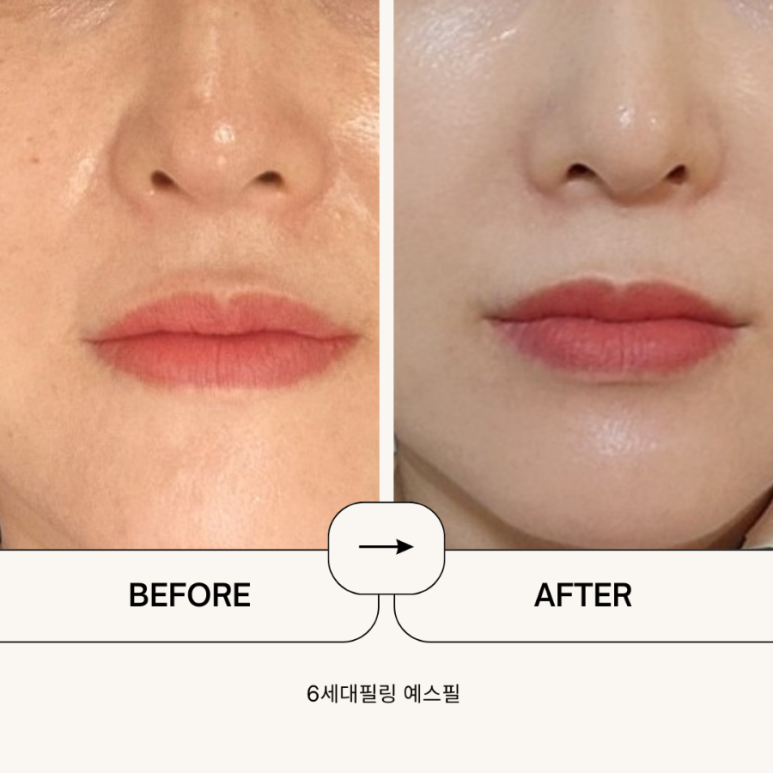 예스압구정 이미지