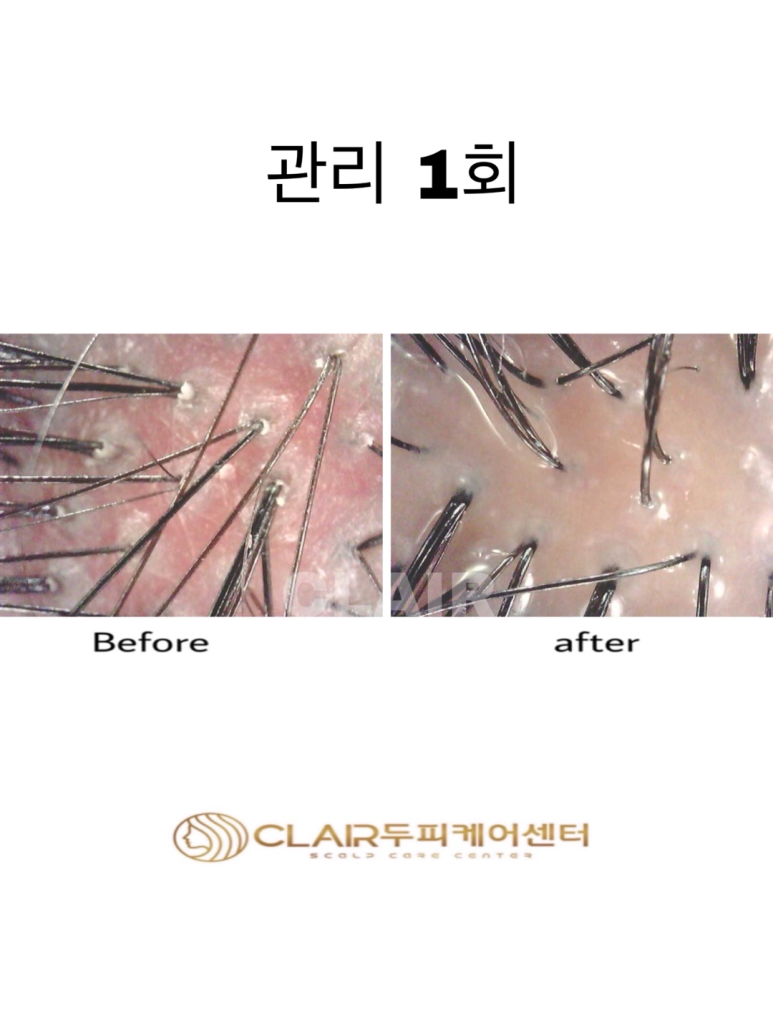 클레르두피케어센터 이미지