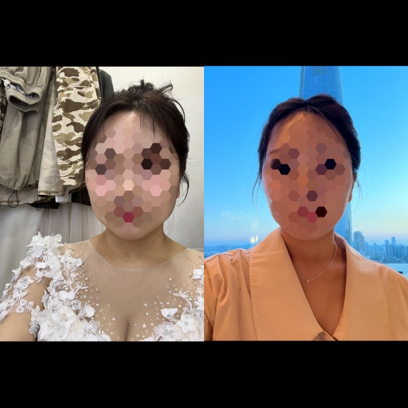 세르모 이미지