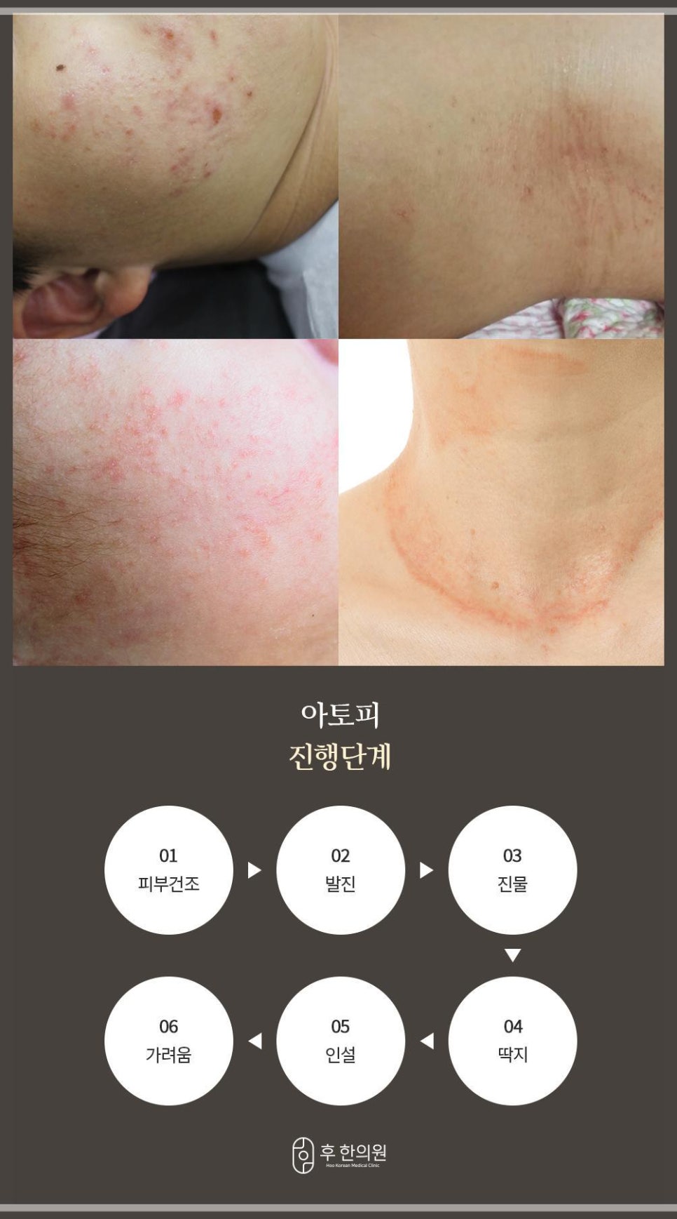 문막한의원 이미지