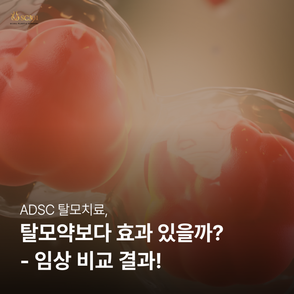 004 ADSC 탈모치료, 탈모약보다 효과 있을까? – 임상 비교 결과!