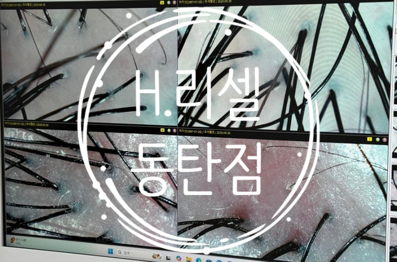 에이치리셀 이미지