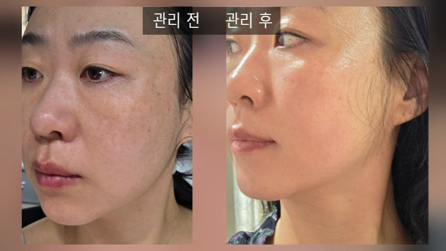 킴스스킨케어 이미지