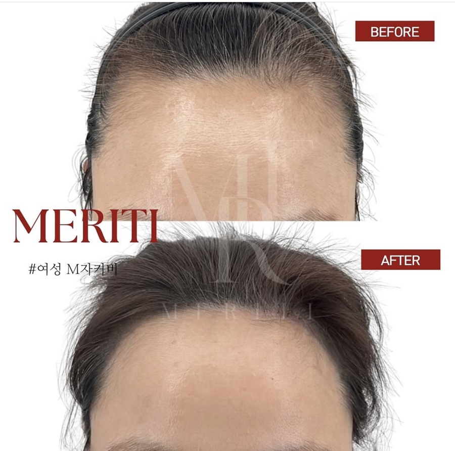 헤어팡팡&가발 이미지