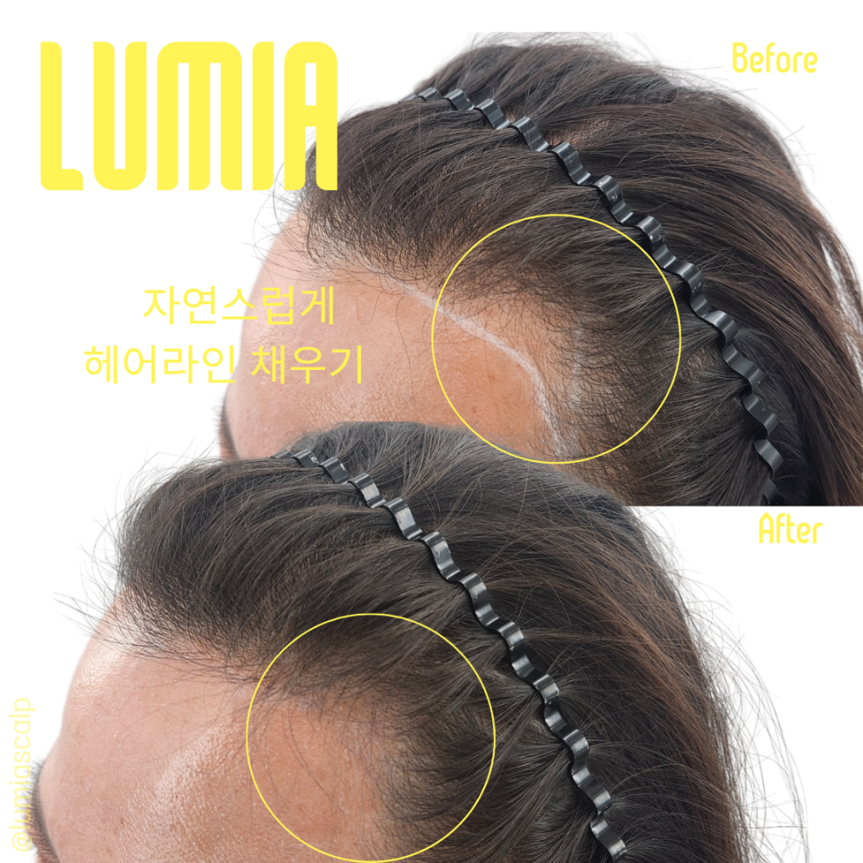 루미아스칼프 이미지