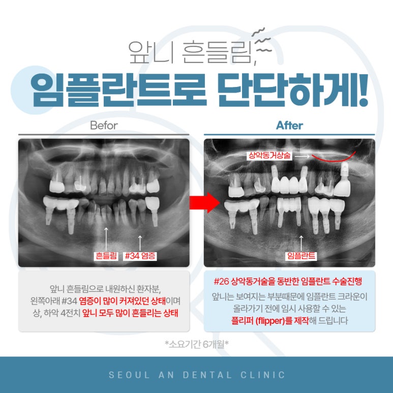 서울에이앤치과 이미지