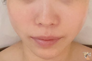 보테에스테틱 이미지