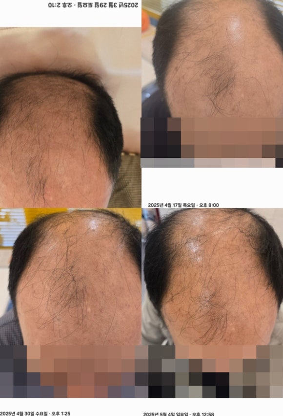 오렌지브로우 이미지
