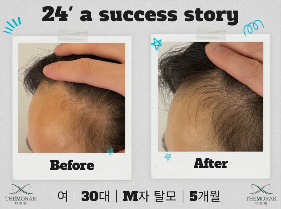 모락별 이미지