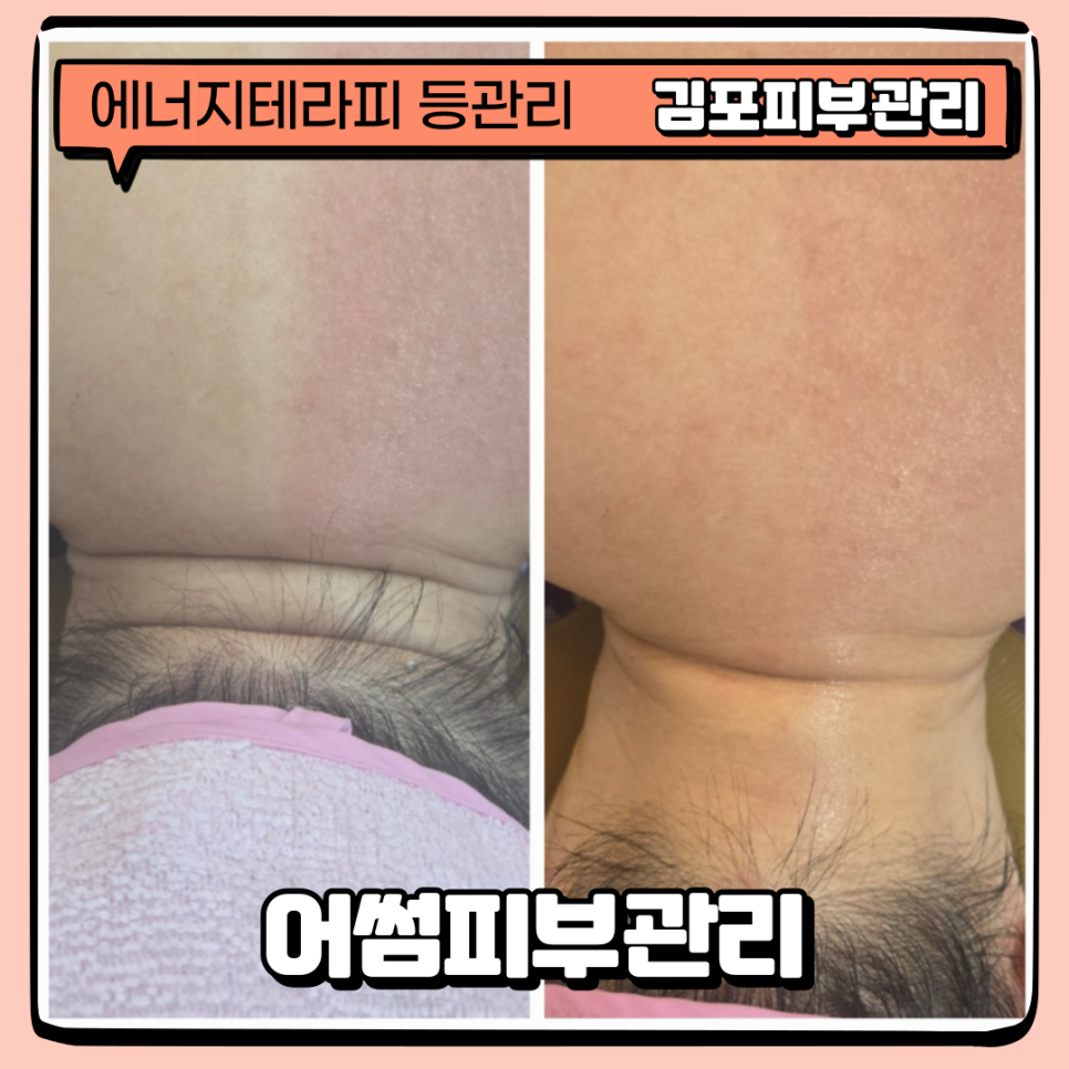 어썸테라피 이미지