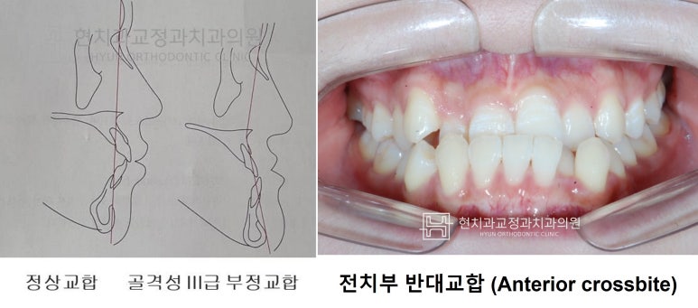 현치과교정과치과의원 이미지