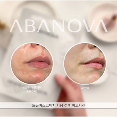 드뉴 이미지