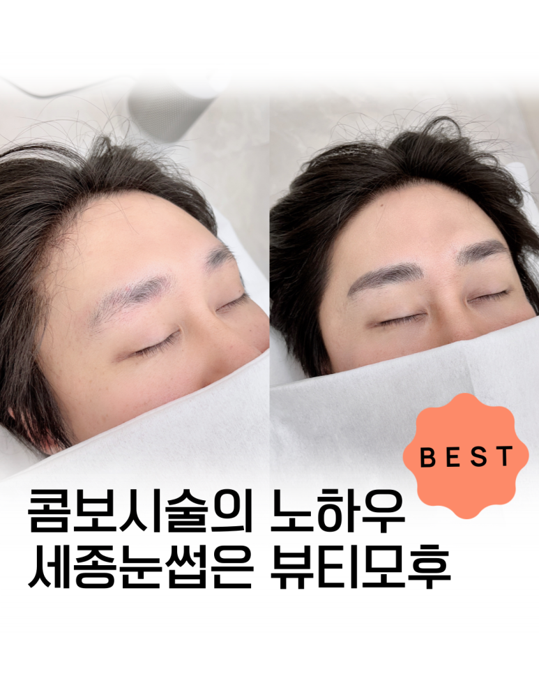 뷰티모후 이미지