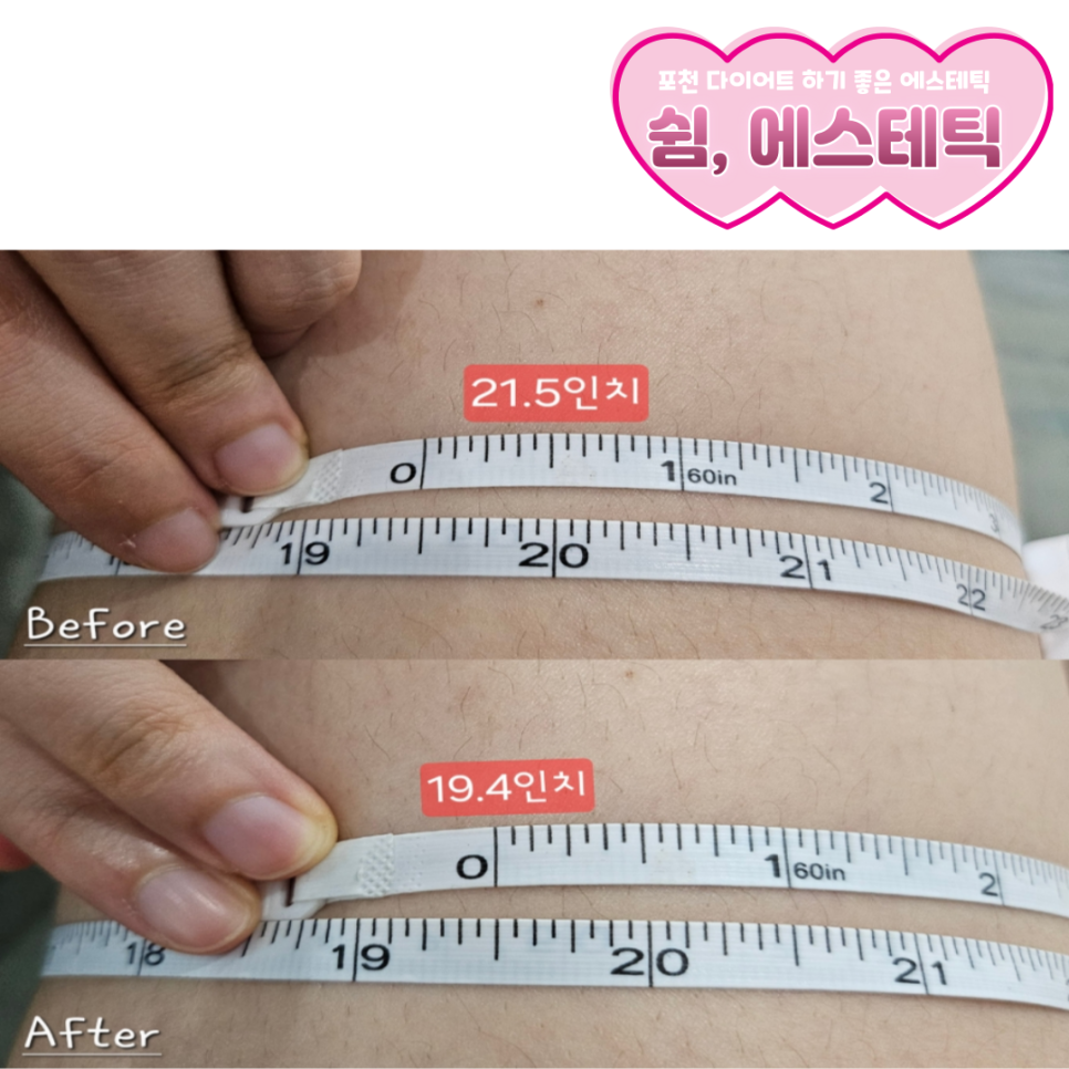 혜원에스테틱 이미지
