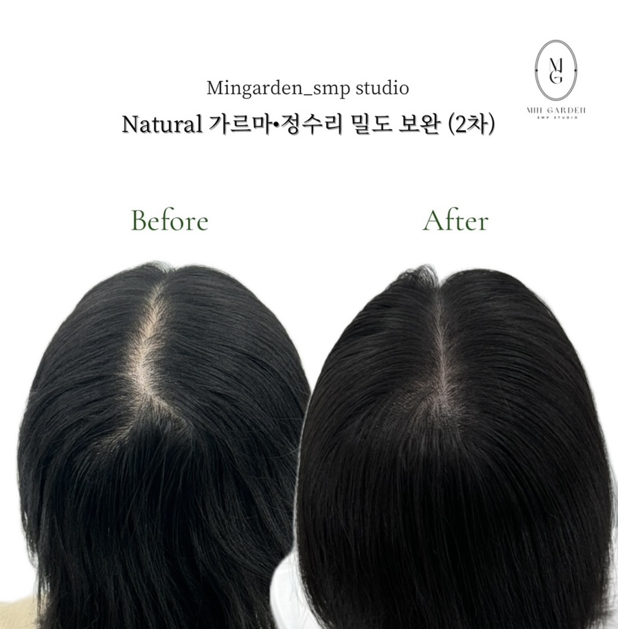 헤어팡팡&가발 이미지