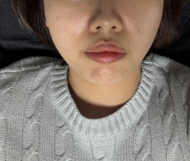 은's 스킨&바디 이미지