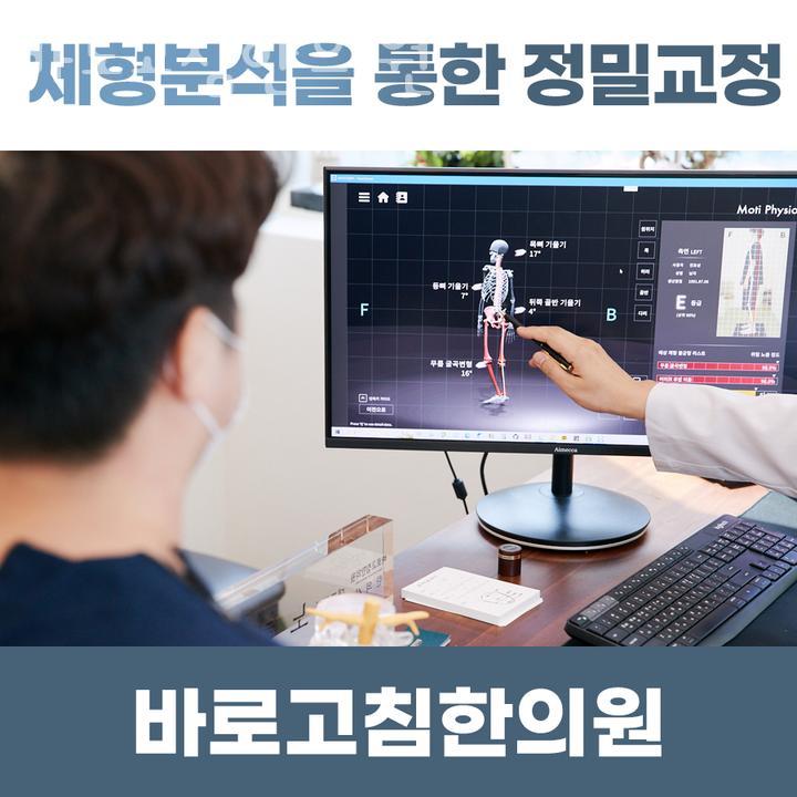 바로고침 이미지