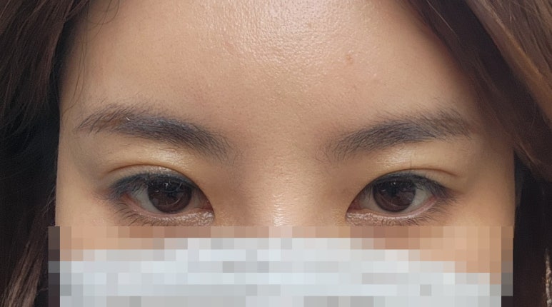 아리솜 이미지