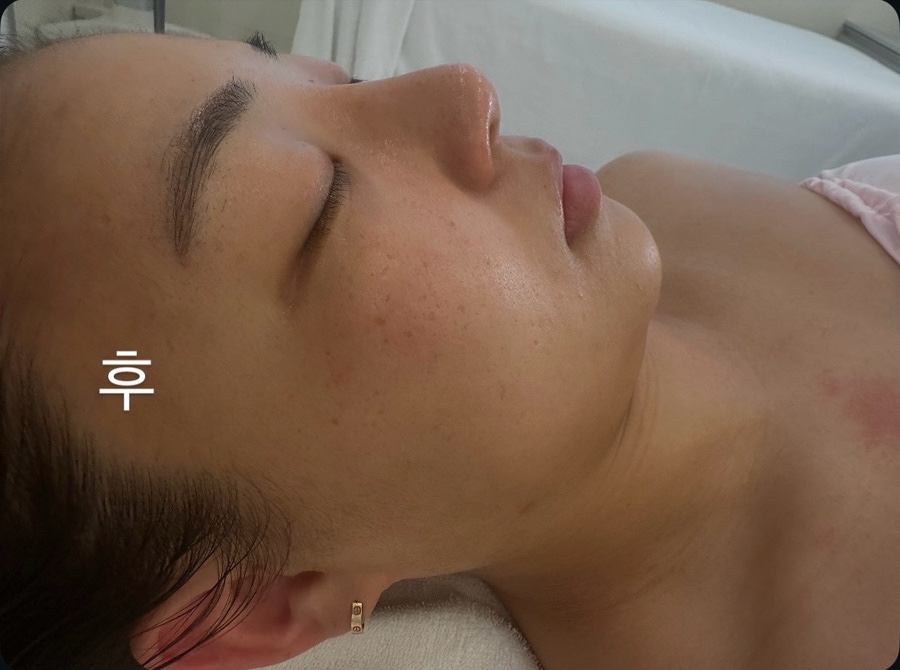 비앙리에 이미지
