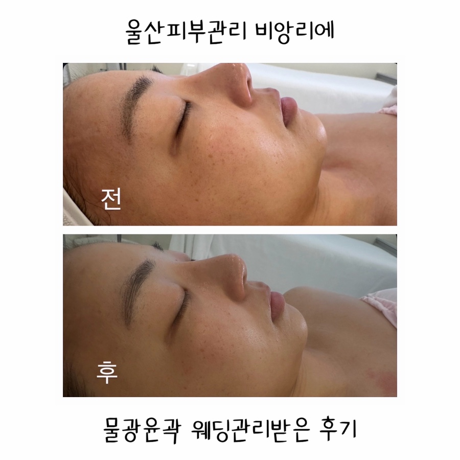 비앙리에 이미지