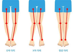 린매스짐 이미지