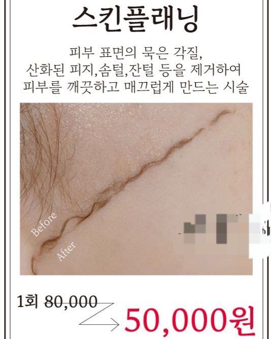 더이쁜피부 이미지