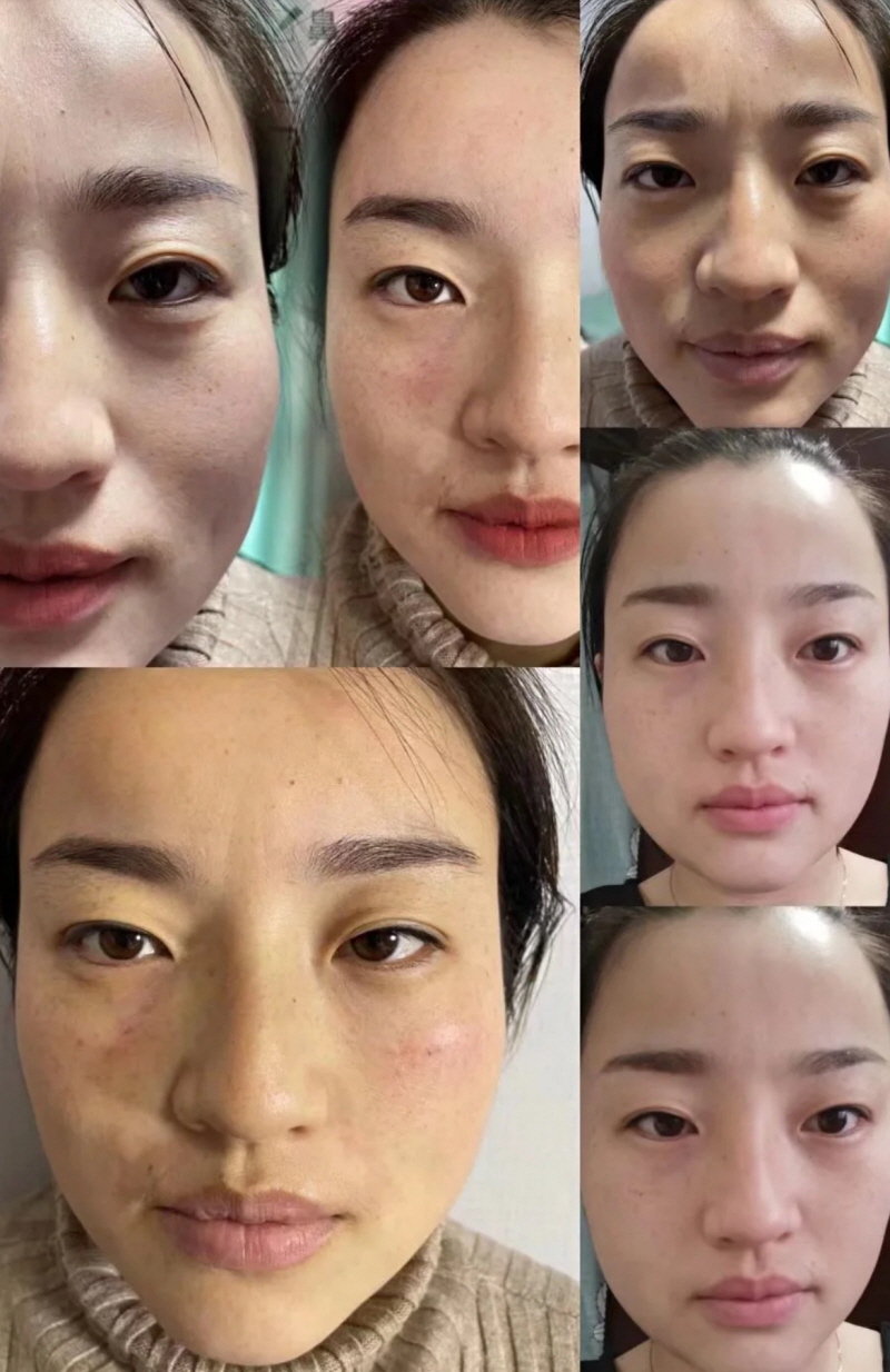 장희빈 이미지