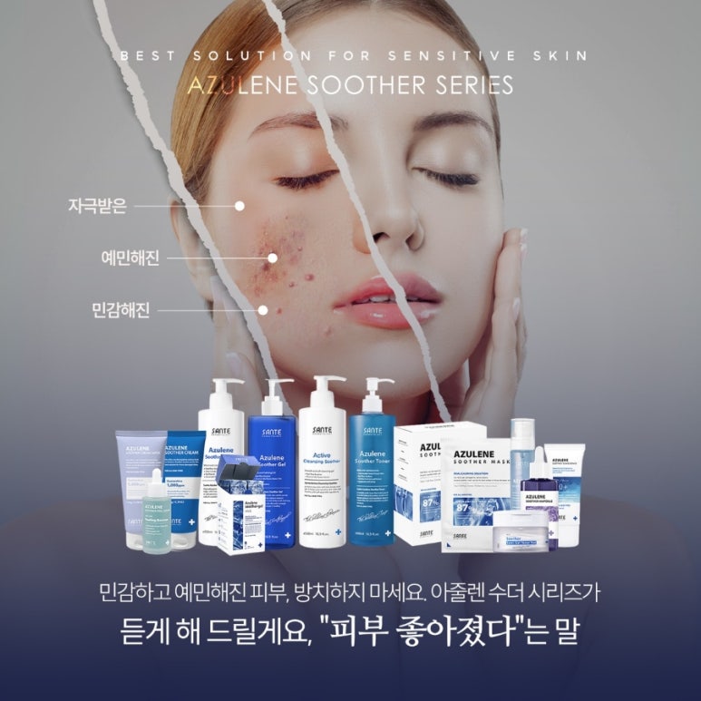상떼 이미지