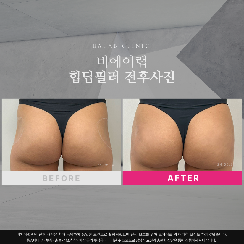 비에이랩의원 이미지