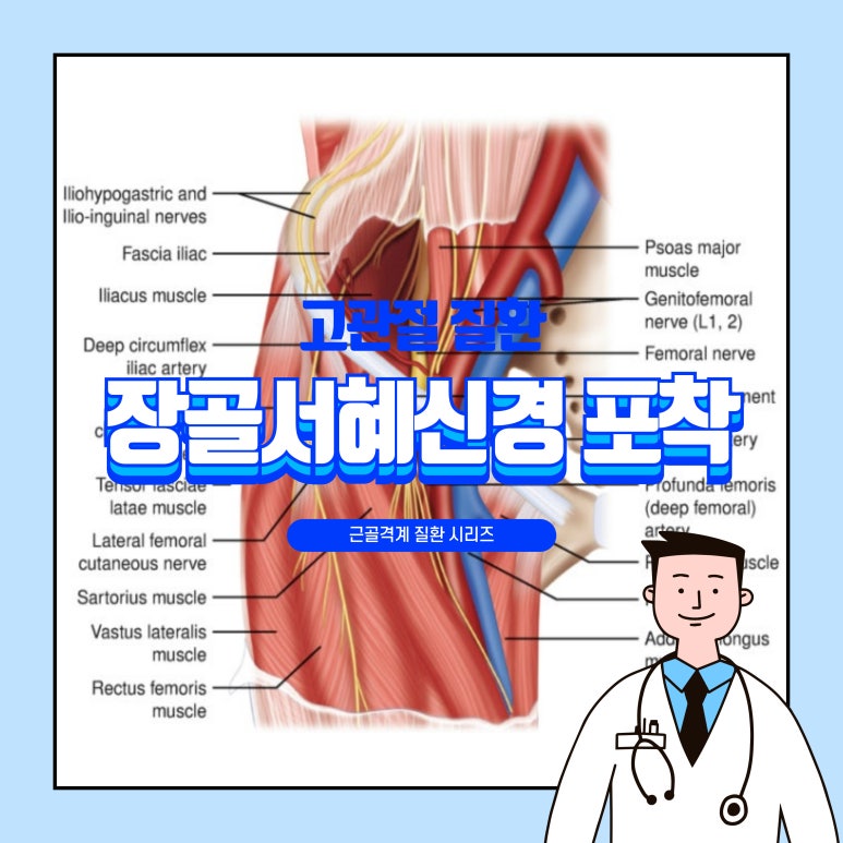 [근골격계_Hip joint] 장골서혜신경 포착증후군 원인 증상 진단 치료: 사타구니통증, 허벅지안쪽통증 음부통증 : 네이버 블로그