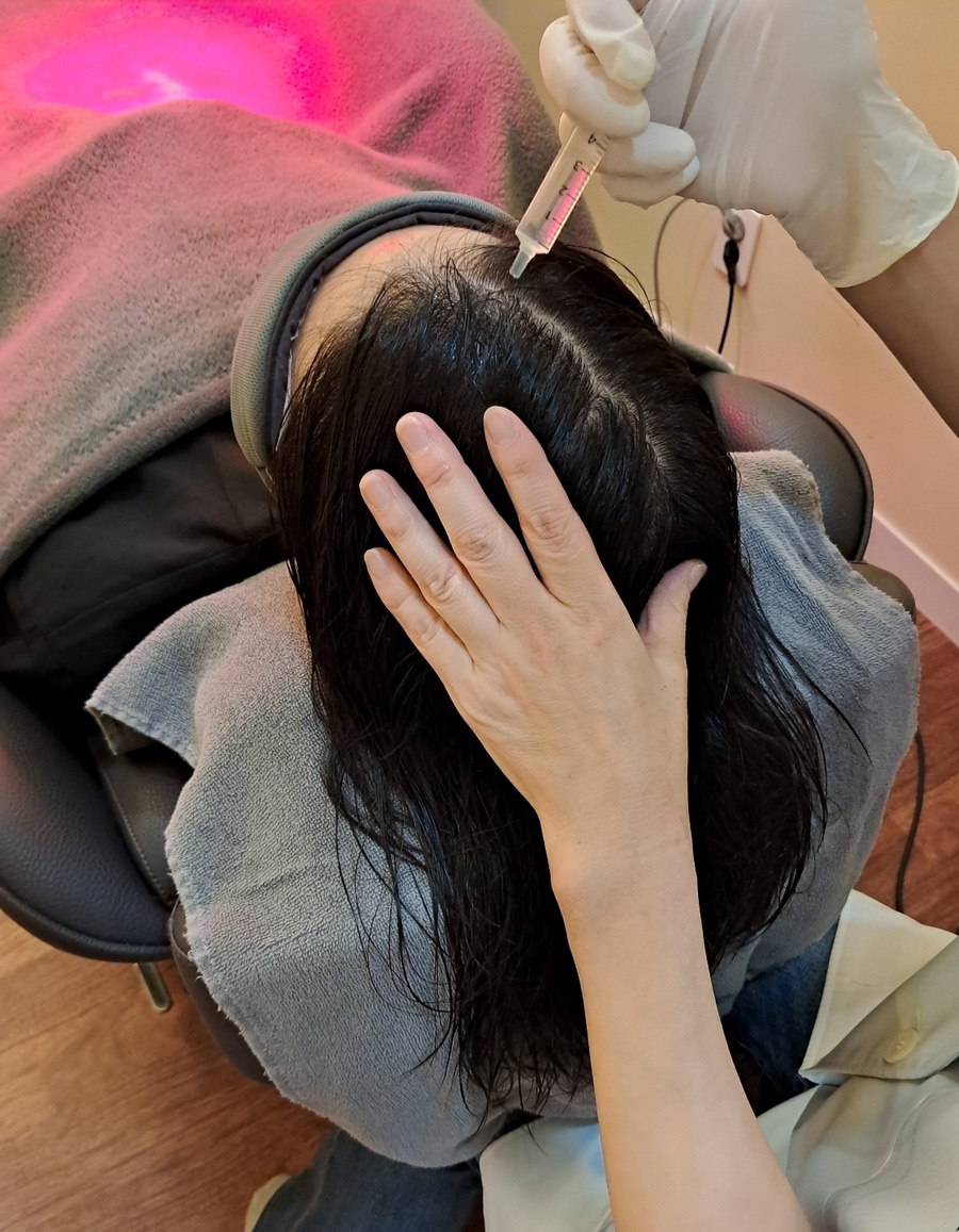 탑스칼프 평내호평점 이미지