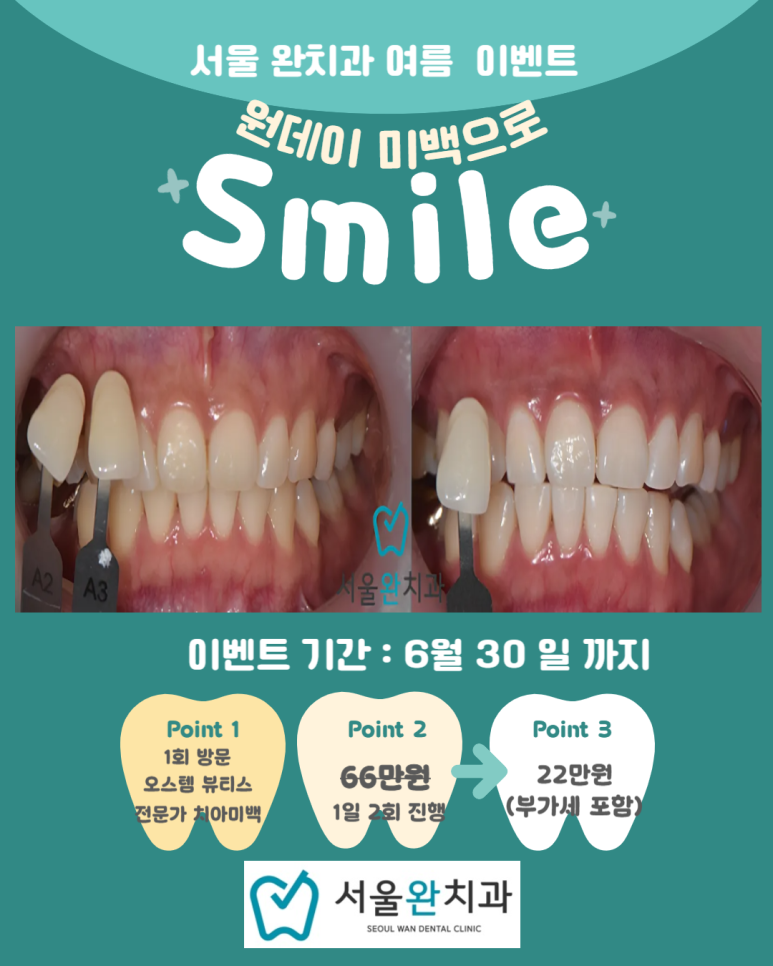 서울완치과 이미지