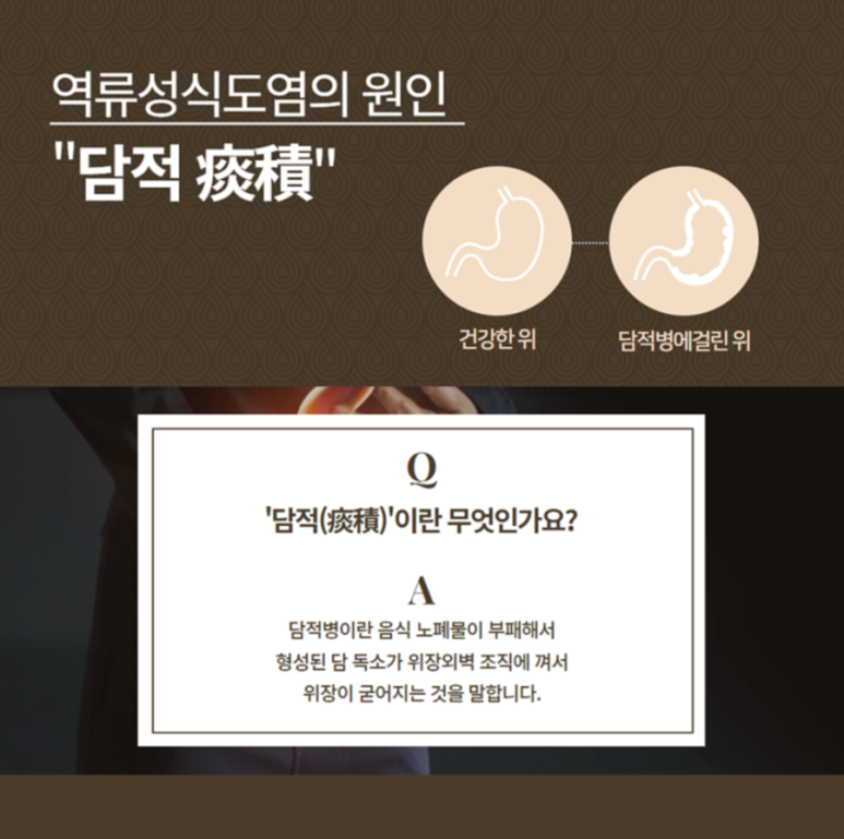목구멍 이미지