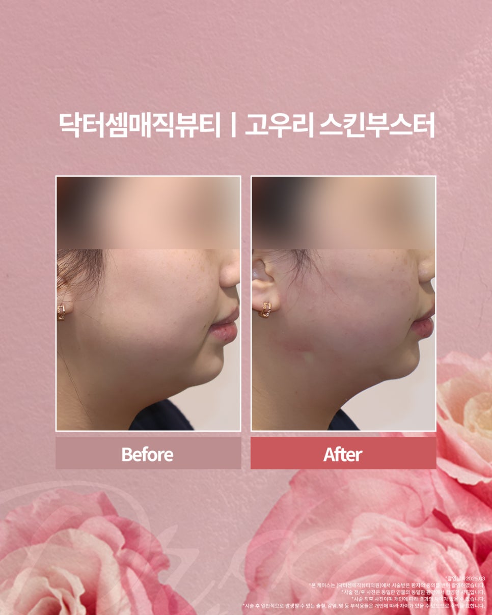 닥터셈매직뷰티 이미지
