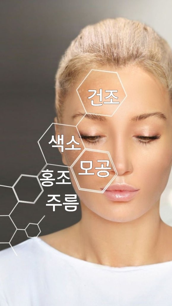 제이비비 이미지