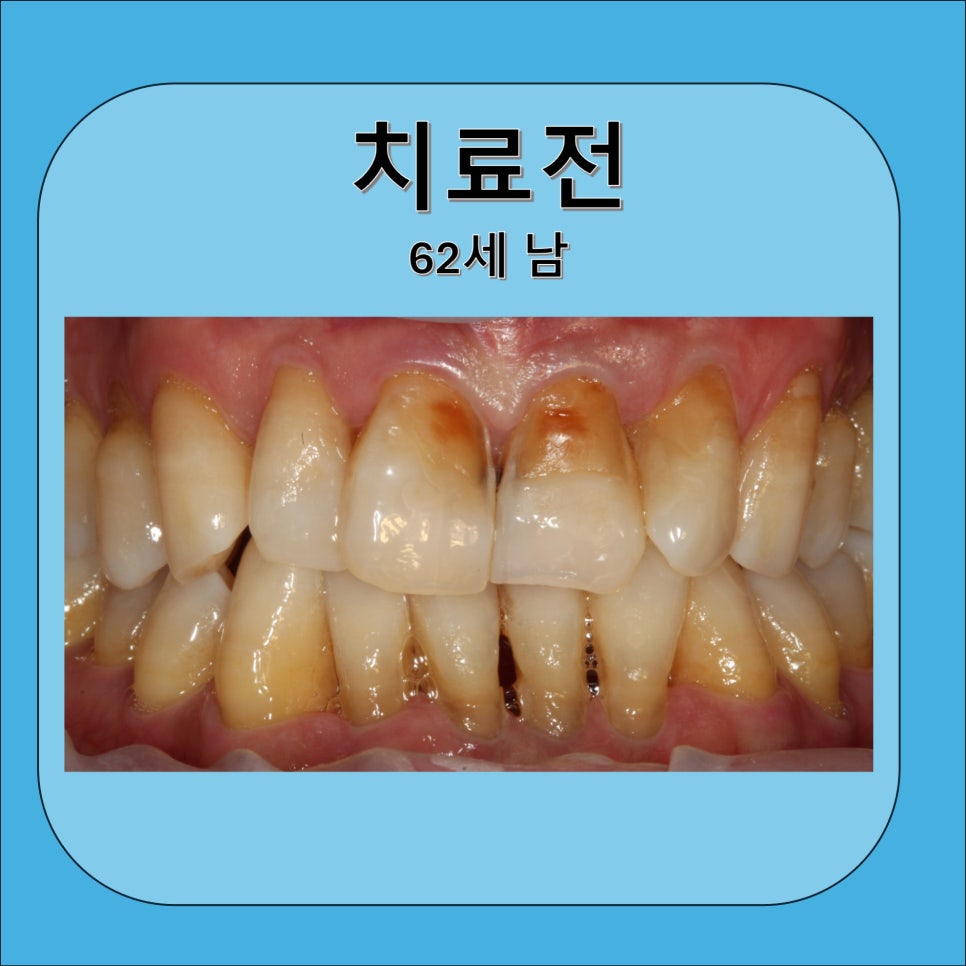 래미안서울치과의원 이미지