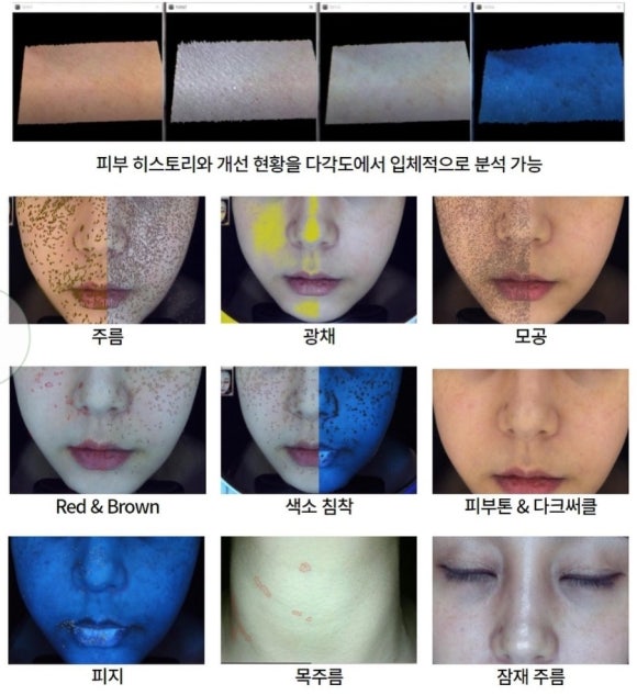 제이비비 이미지