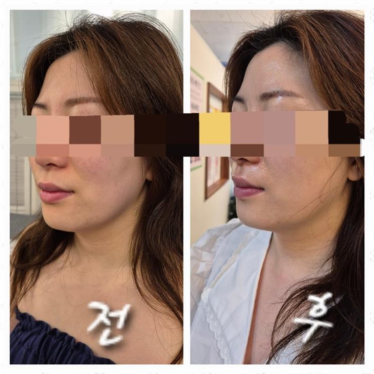 뷰티몬스터 이미지