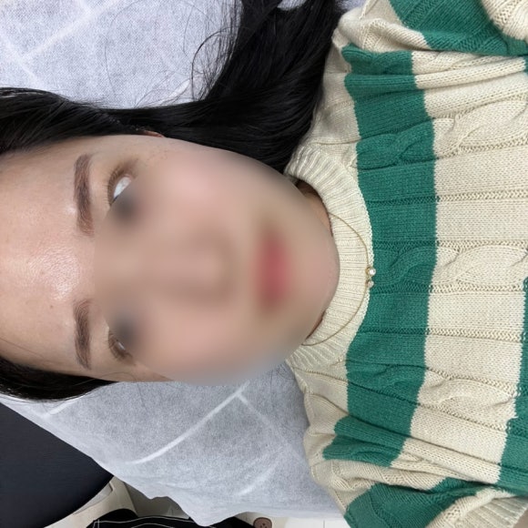 보니움 이미지
