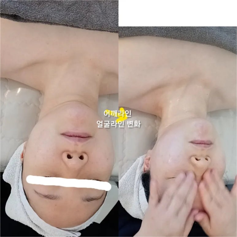 예화 에스테틱 이미지