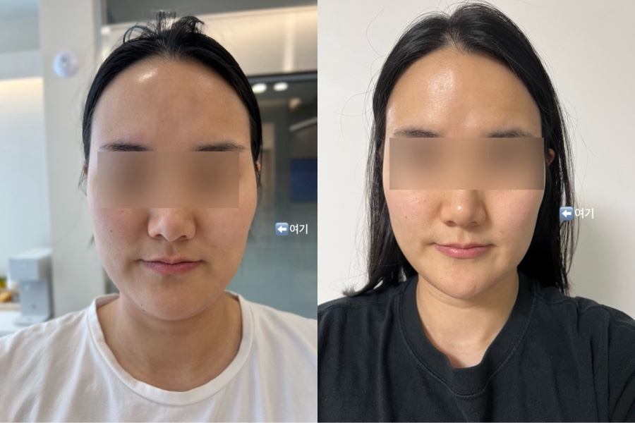 라인미 이미지