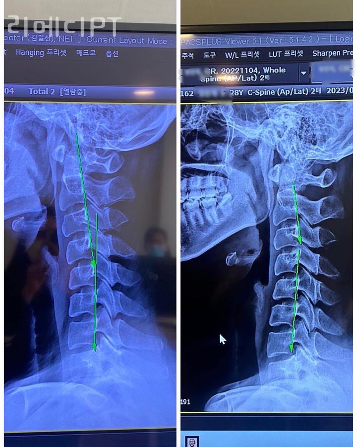 리메디PT 이미지