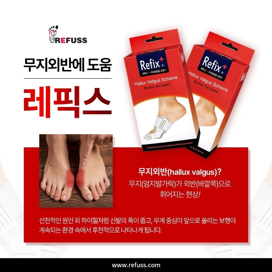 레푸스 이미지