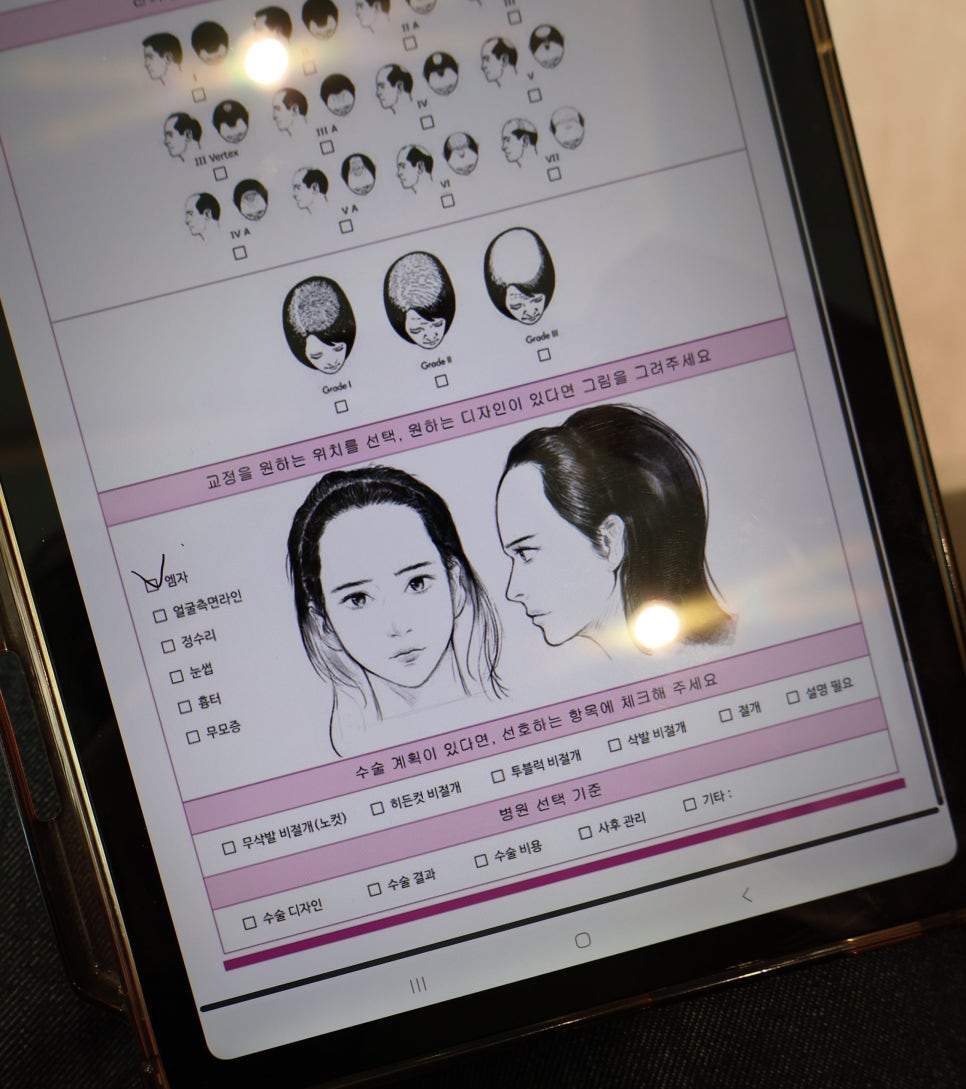 현헤어라인 이미지