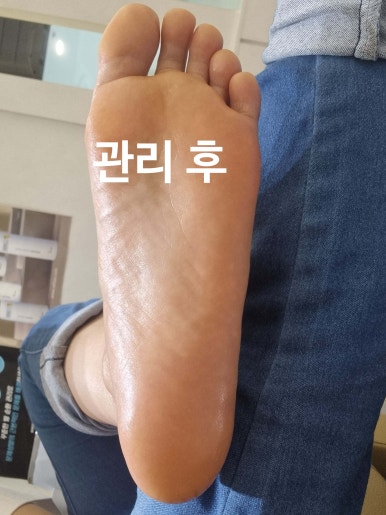 네일리코레푸스 이미지