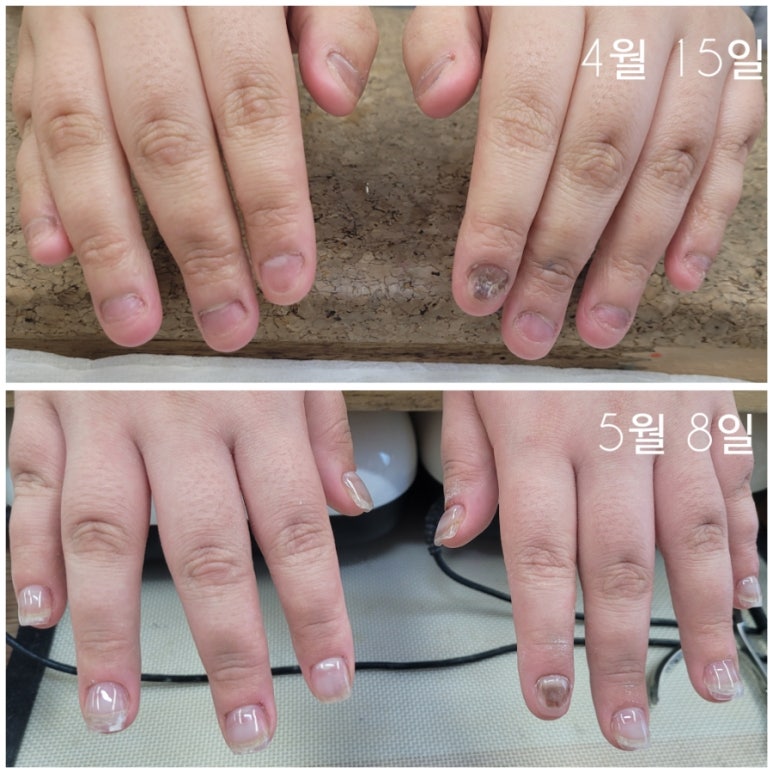 빛담네일 이미지