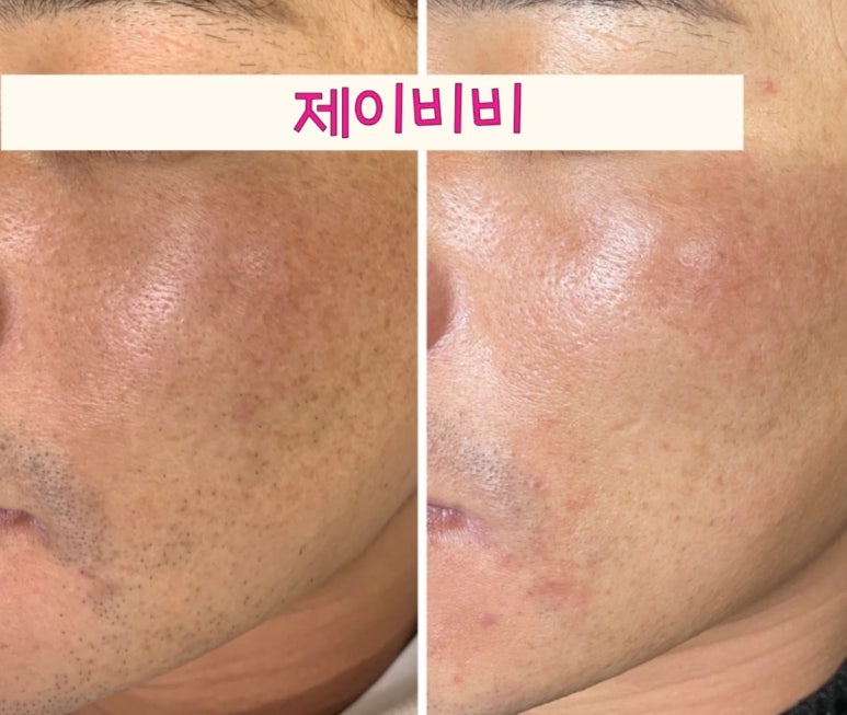 제이비비 이미지